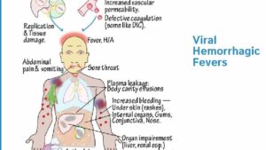 vhf_fever